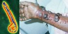 Epidemiolog: Virus Marburg Sangat Berpotensi jadi Pandemi dengan Kematian Tinggi