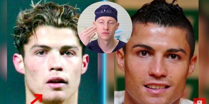 Begini Metamorfosis Wajah Cristiano Ronaldo dari Tahun ke Tahun, Dokter Sebut Operasi