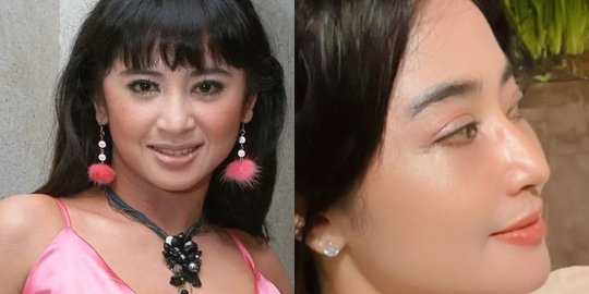 6 Potret Transformasi Dewi Perssik dari Awal Karier hingga Jalani Transfer Lemak