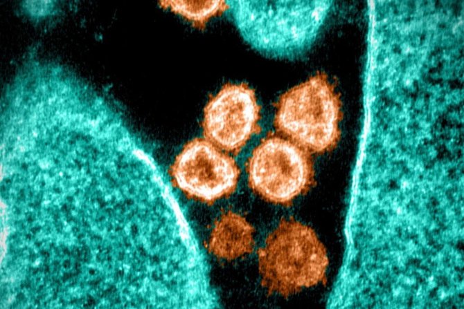 virus corona penyebab covid 19 sars cov 2 atau yang juga disebut dengan 2019 ncov