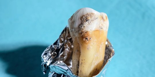 Bakteri Kuno dari 100.000 Tahun Lalu Dihidupkan Kembali, Ini yang Kemudian Terjadi