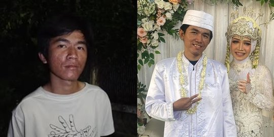 Tiko Anak Bu Eny Resmi Menikah dengan Kekasih, Intip Potretnya