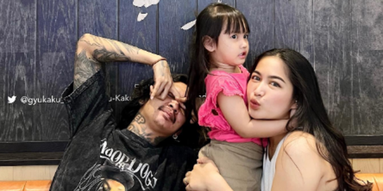 Mainan Sepatu Barbie Masuk ke Hidung, Anak Young Lex Langsung Dilarikan ke RS