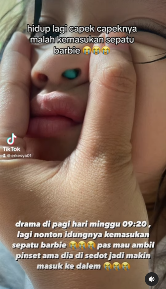 mainan sepatu barbie masuk ke hidung anak young lex dilarikan ke rs