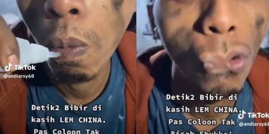 Bikin Heran Warganet, Pria Ini Oleskan Lem China ke Bibirnya