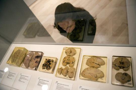 Pameran koleksi otak di London