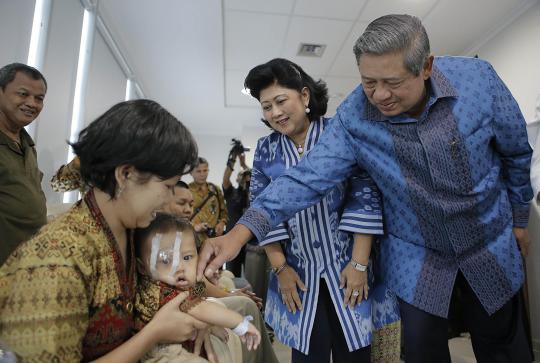Jokowi dampingi Presiden SBY resmikan unit kesehatan mata RSCM
