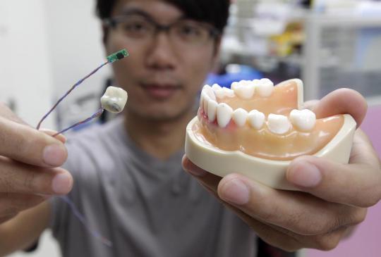 Smart Tooth, gigi palsu pendeteksi kesehatan di dalam mulut