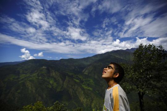 Kisah keluarga di Nepal penderita sindrom manusia serigala