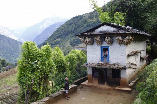 Kisah keluarga di Nepal penderita sindrom manusia serigala