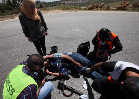 Salah keker, polisi Israel tembak kaki fotografer