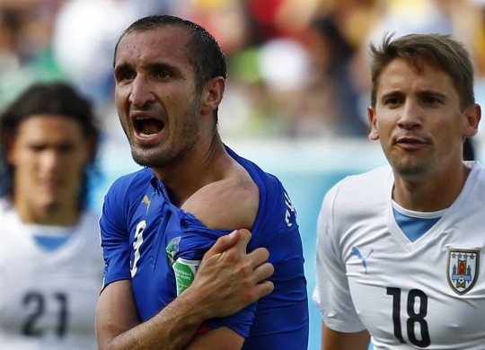 Ini bahu Chiellini yang jadi korban gigitan Luis Suarez