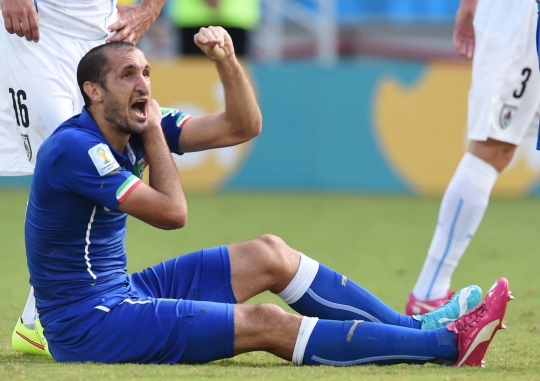 Ini bahu Chiellini yang jadi korban gigitan Luis Suarez