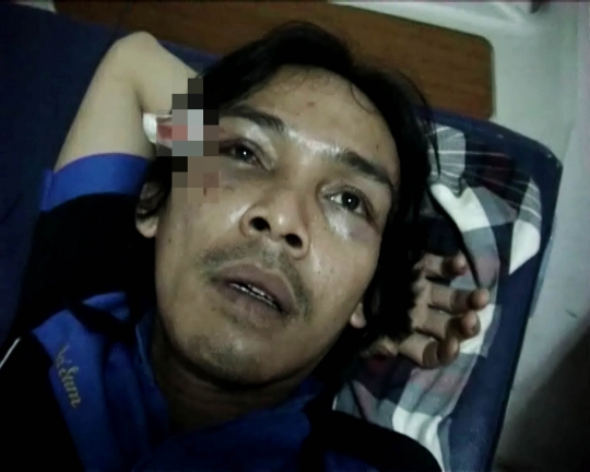 Pedagang pecel lele di Medan dikeroyok kawanan yang ngaku polisi