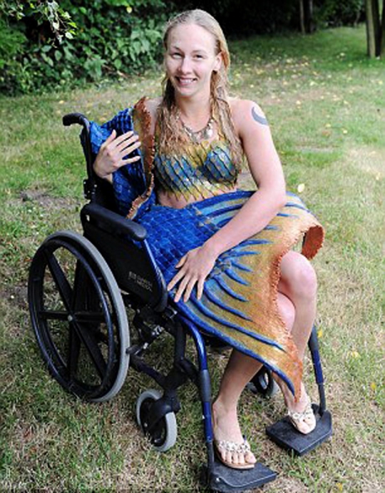 Wanita ini sembuh dari cacat kaki setelah jadi putri duyung