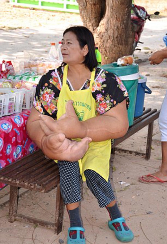 Ini wanita Thailand yang punya tangan raksasa