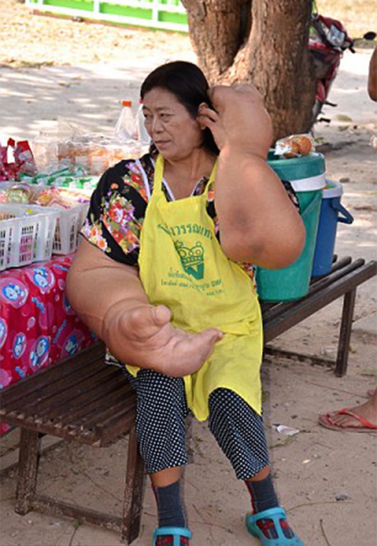 Ini wanita Thailand yang punya tangan raksasa