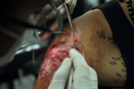 Ekstremnya pembuatan tato skarifikasi di Ekuador