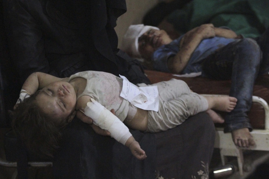 Derita bocah Suriah kembali jadi korban kekejaman pasukan Assad
