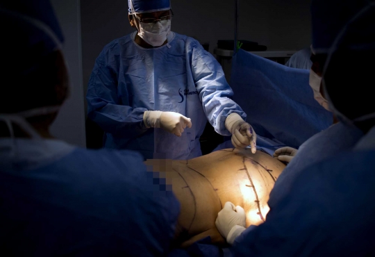 Mengintip operasi turunkan berat badan hingga 50 kg di Kolombia