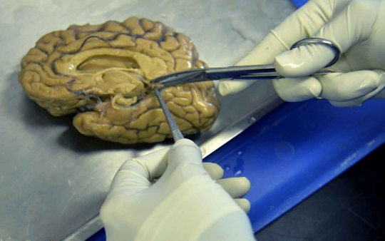 Ini foto-foto di bank otak, lihatnya bikin merinding