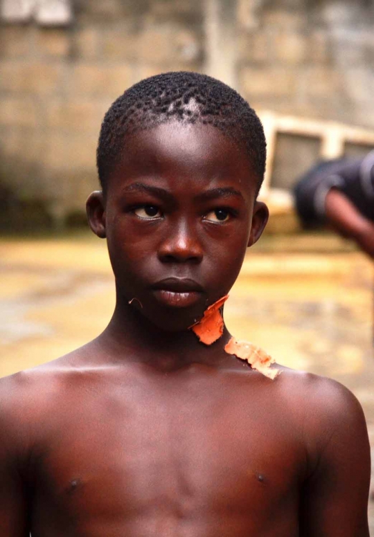 Derita anak-anak di Pantai Gading jadi sasaran teror mutilasi