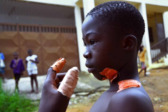 Derita anak-anak di Pantai Gading jadi sasaran teror mutilasi