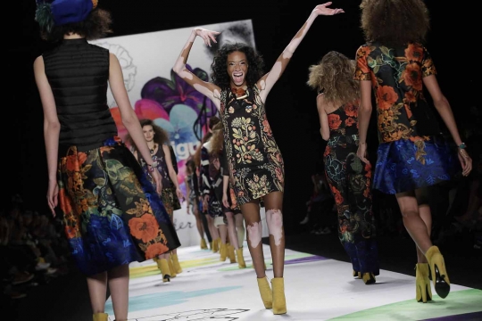 Mengenal Winnie Harlow, wanita pengidap vitiligo yang jadi model top