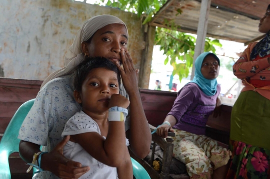 Kisah sedih balita Rohingya di Aceh meninggal karena gizi buruk