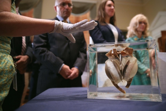 Ini jantung buatan pertama yang berhasil selamatkan manusia