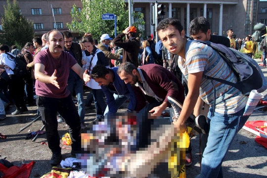 Serangan bom teror aksi damai di Turki, 30 orang tewas