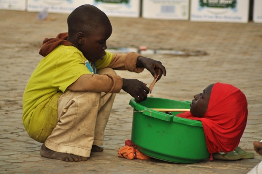 Potret miris gadis cacat Nigeria tergolek lemah di dalam baskom