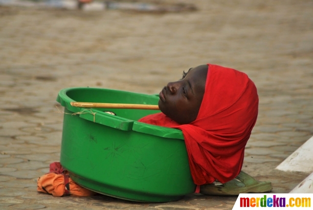 Foto Potret miris gadis cacat  Nigeria tergolek lemah di 