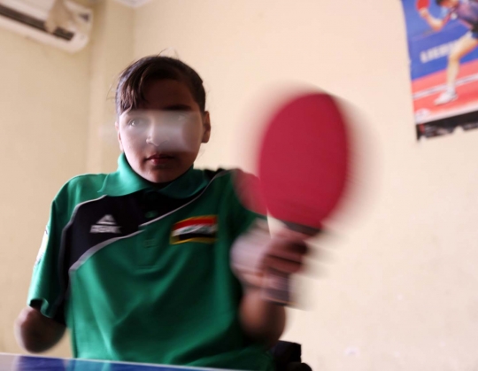 Kisah bocah tanpa kaki di Irak yang jago main pingpong