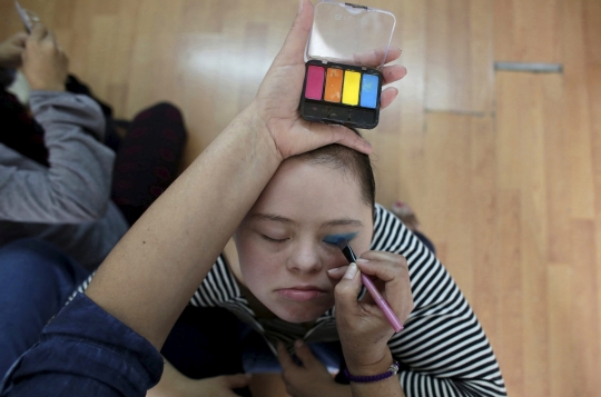 Kisah penderita down syndrome bertahan hidup jadi penari keliling