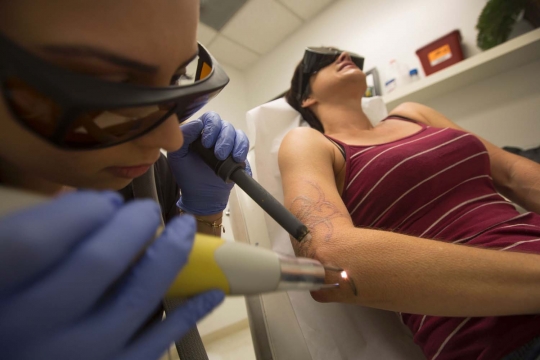Geliat bisnis penghapusan tato yang semakin marak di AS