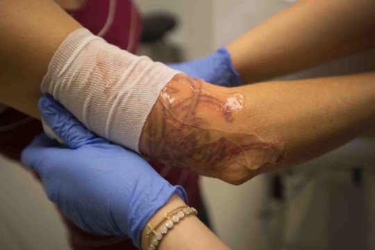 Geliat bisnis penghapusan tato yang semakin marak di AS