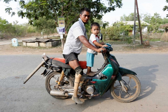 Menengok nasib veteran perang Myanmar hidup dengan kaki palsu