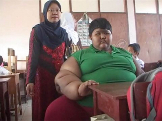 Semangat Arya bocah obesitas kembali ke sekolah