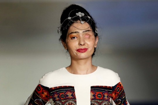 Semangat wanita korban air keras jadi model New York Fashion Week