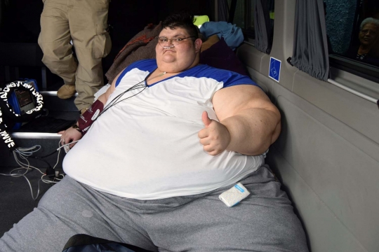 Pria obesitas berbobot 500 kg ini 6 tahun cuma bisa tiduran