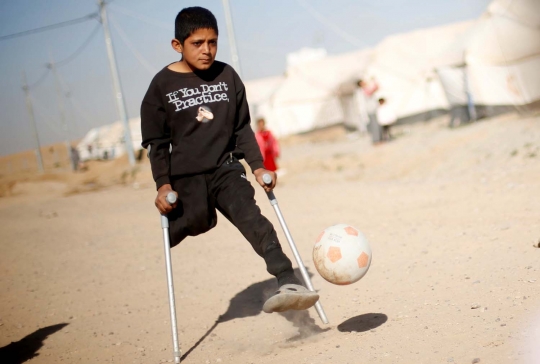 Semangat hidup Jasim, bocah kehilangan satu kaki akibat perang Irak