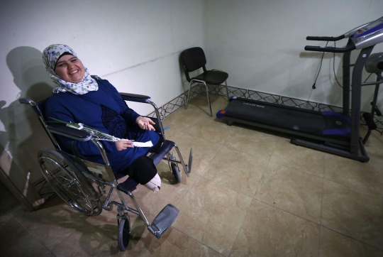 Meratapi warga Mosul kehilangan kaki akibat serangan ISIS