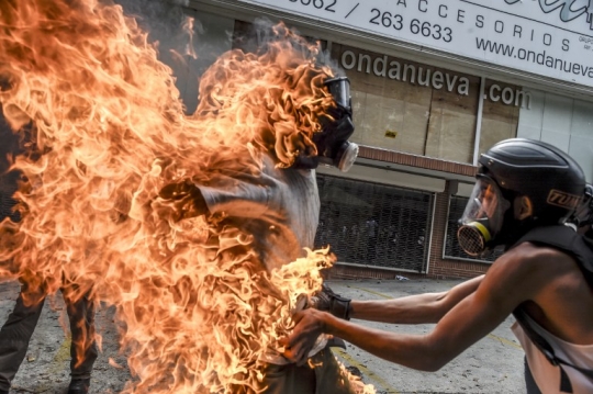 Menegangkan, demonstran penentang Presiden Maduro terbakar