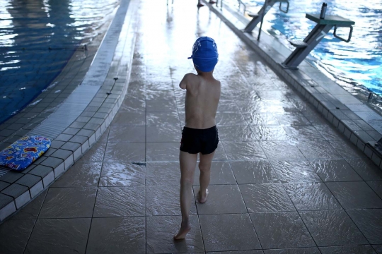 Kisah Ismail, bocah tanpa tangan yang jago berenang