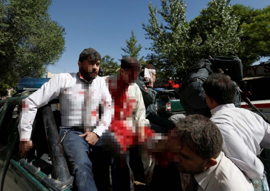 Mengerikan, korban bom Afghanistan berubah jadi 'zombie'