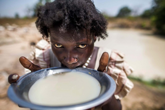 Nestapa warga Sudan Selatan dilanda kelaparan dan krisis air bersih