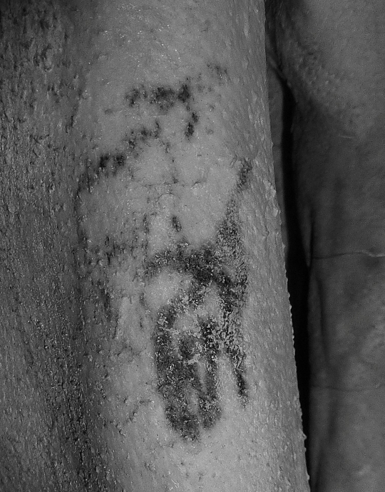 Penampakan tato tertua sejagat di tubuh mumi Mesir kuno