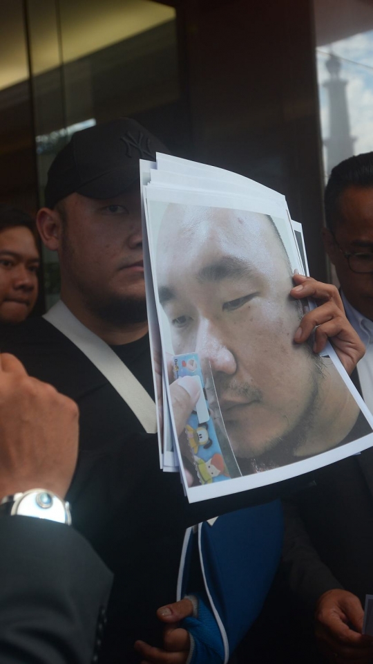 Korban penganiayaan oleh oknum diduga anggota DPR melapor Polres Metro Jaksel