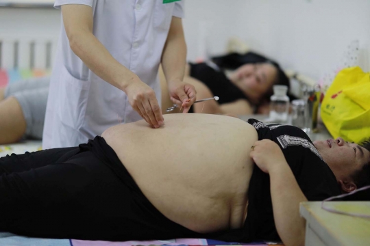 Mengintip cara tradisional China atasi obesitas